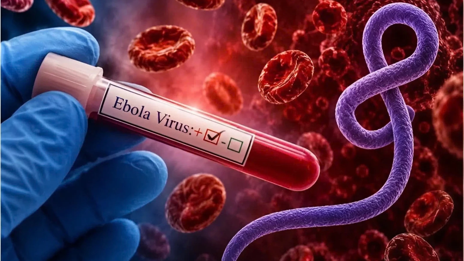 Tỷ lệ tử vong khi mắc Ebola có thể lên tới 90%